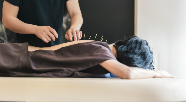 An acupuncturist placing thin needles along a patient's upper back